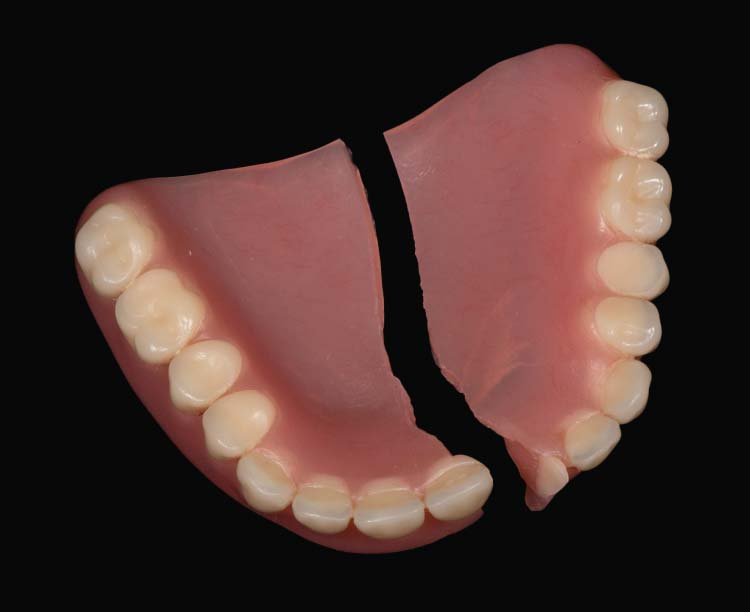 Broken denture emergency guide